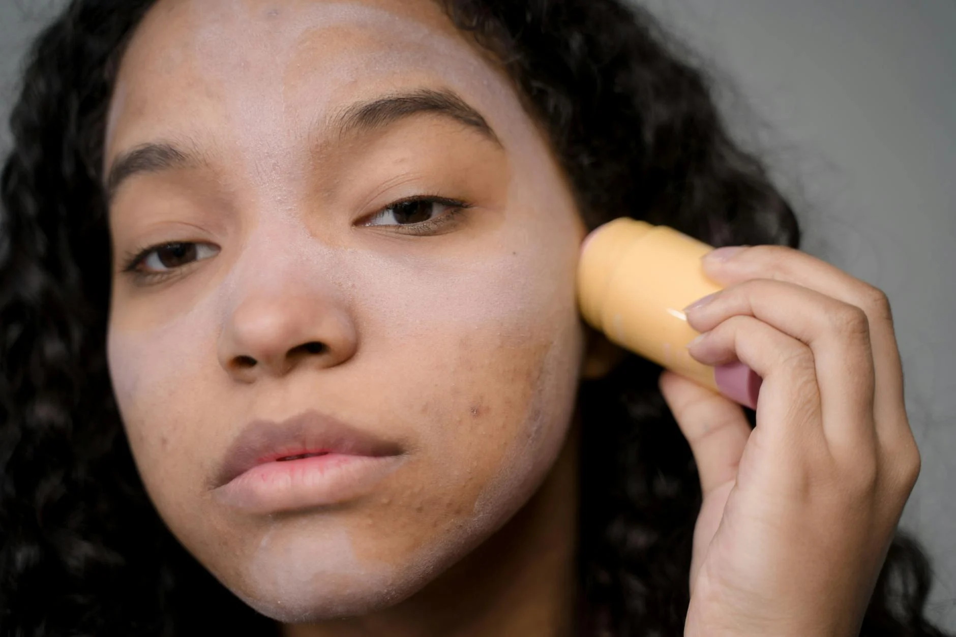 Best Korean Skincare Products for Acne-Prone Skin in 2025